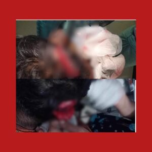 photo output 2 TEKNAF TODAY - সীমান্তের সর্বশেষ খবর